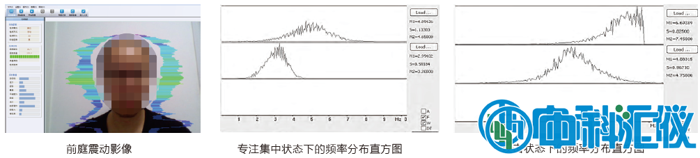 心理健康状态检测.png