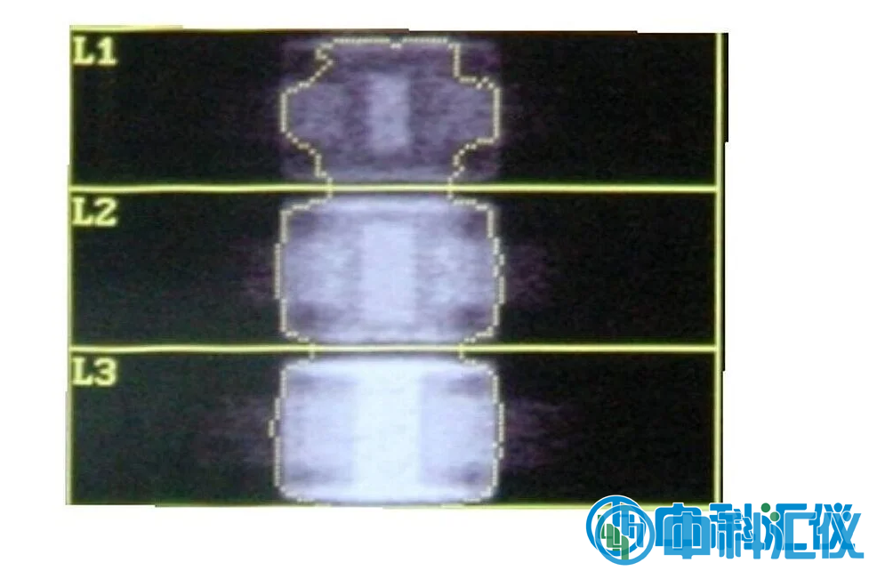 1768968061963213.png QRM-ESP 的 DXA 扫描(说明见以上文字) (1).png