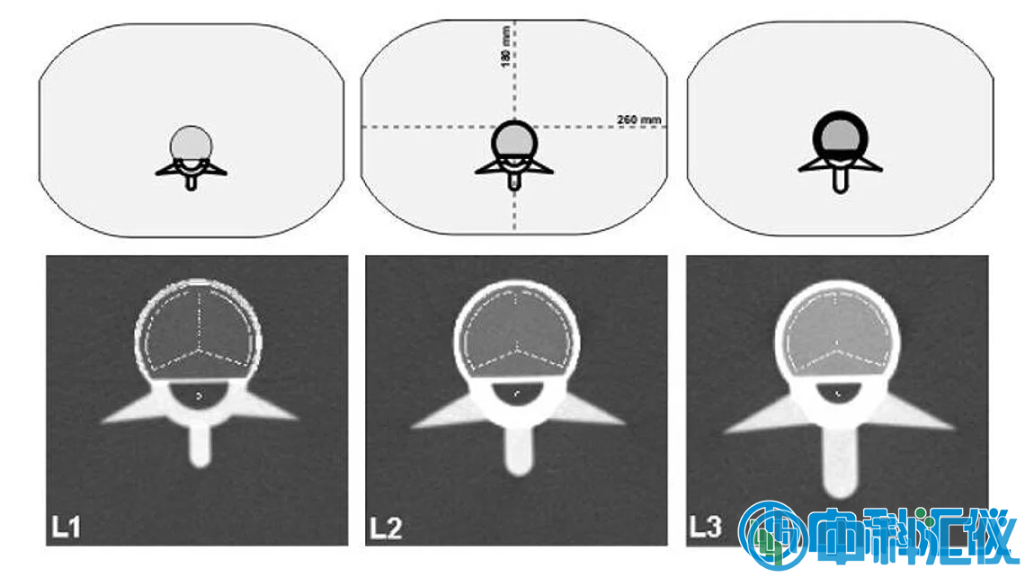 1768968098572858.png QRM-ESP 的 CT 图像。椎体中段扫描图像,并叠加了自动确定的松质骨和皮质骨 ROI。.png